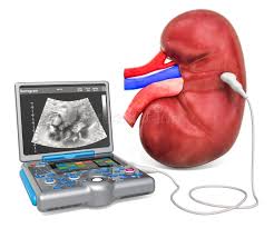 سونوگرافی کلیه